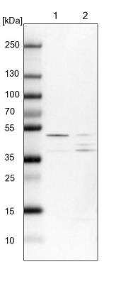 Western Blot: SPRYD3 Antibody [NBP1-83681]