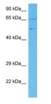 Western Blot: SPRYD3 Antibody [NBP3-09398]