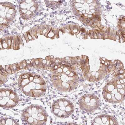 Immunohistochemistry: SPRYD4 Antibody [NBP2-30992]