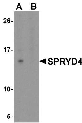 Western Blot: SPRYD4 AntibodyBSA Free [NBP1-77100]