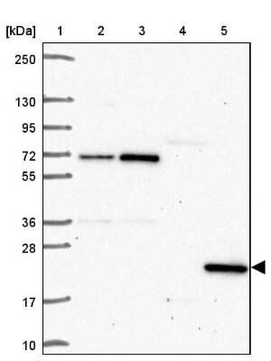 Western Blot: SPRYD4 Antibody [NBP2-30992]