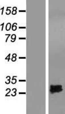 Western Blot: SPRYD4 Overexpression Lysate [NBL1-16436]