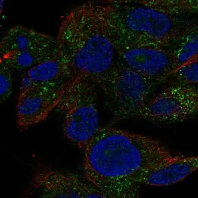 Immunocytochemistry/ Immunofluorescence: SPRYD5 Antibody [NBP2-69053]