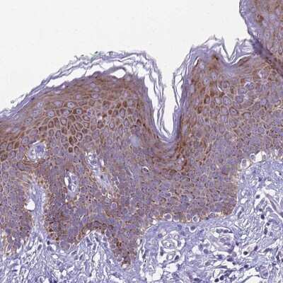 Immunohistochemistry-Paraffin: SPRYD5 Antibody [NBP2-13375]