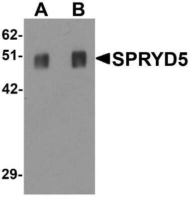 Western Blot: SPRYD5 AntibodyBSA Free [NBP1-77087]