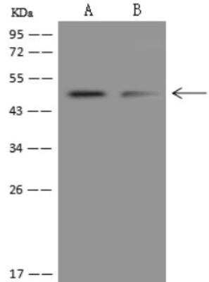 Western Blot: SPRYD5 Antibody [NBP3-05859]