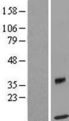 Western Blot: SPRYD5 Overexpression Lysate [NBP2-05982]