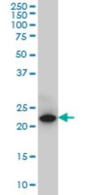 Western Blot: SPRYD7 Antibody (2G4) [H00057213-M01]