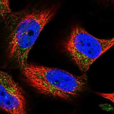 Immunocytochemistry/ Immunofluorescence: SPRYD7 Antibody [NBP1-92443]