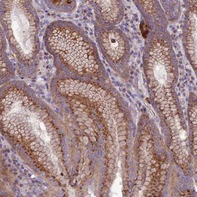 Immunohistochemistry-Paraffin: SPRYD7 Antibody [NBP1-92443]