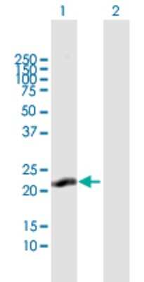 Western Blot: SPRYD7 Antibody [H00057213-B01P]