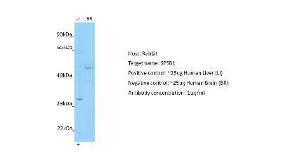 Western Blot: SPSB1 Antibody [NBP2-86827]