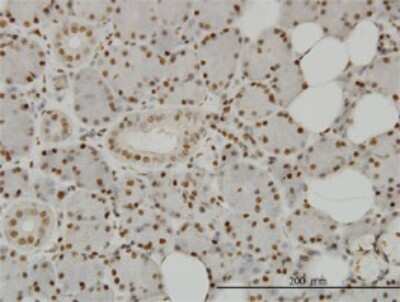 Immunohistochemistry-Paraffin: SPSB2 Antibody (1E6) [H00084727-M01]