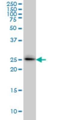 Western Blot: SPSB2 Antibody (1E6) [H00084727-M01]