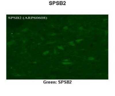Immunohistochemistry: SPSB2 Antibody [NBP1-74266]