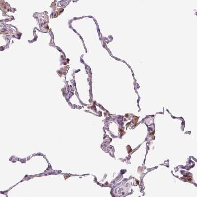 Immunohistochemistry-Paraffin: SPSB2 Antibody [NBP2-30569]