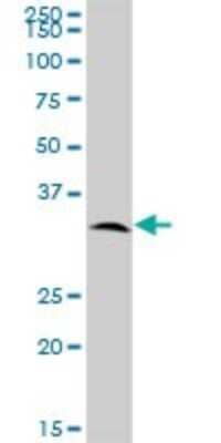 Western Blot: SPSB2 Antibody [H00084727-B01P]