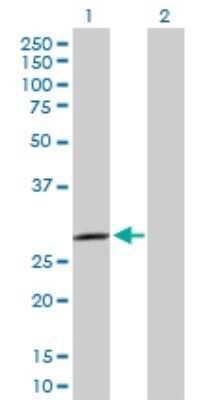 Western Blot: SPSB2 Antibody [H00084727-D01P]