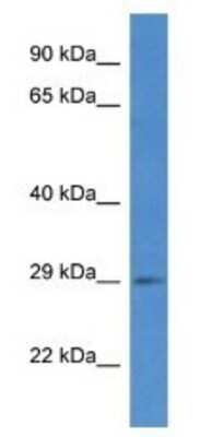 Western Blot: SPSB2 Antibody [NBP1-74266]