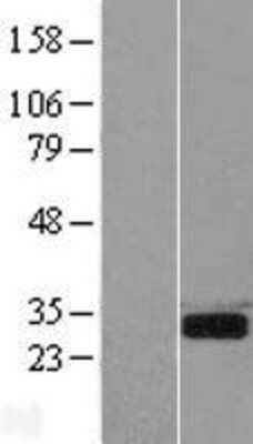 Western Blot: SPSB2 Overexpression Lysate [NBP2-10188]