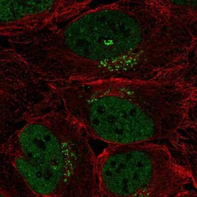 Immunocytochemistry/ Immunofluorescence: SPSB4 Antibody [NBP2-68795]