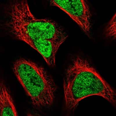 Immunocytochemistry/ Immunofluorescence: SPT3 Antibody [NBP1-87007]