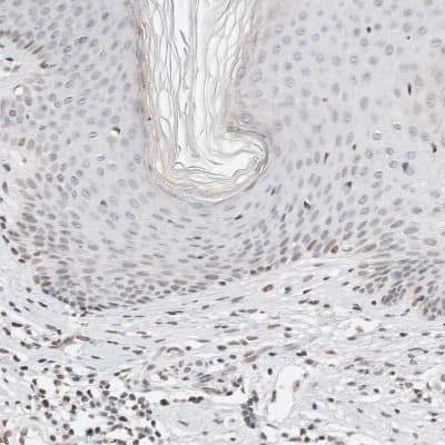 Immunohistochemistry-Paraffin: SPT3 Antibody [NBP1-87007]