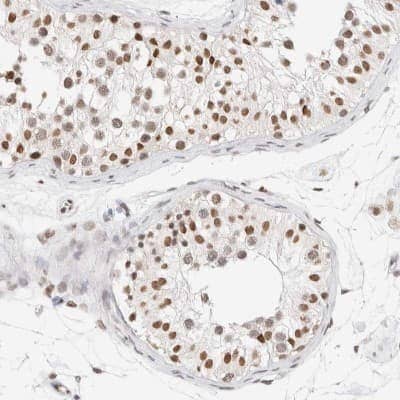 Immunohistochemistry-Paraffin: SPT3 Antibody [NBP1-87007]