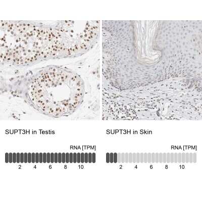 Immunohistochemistry-Paraffin: SPT3 Antibody [NBP1-87007]