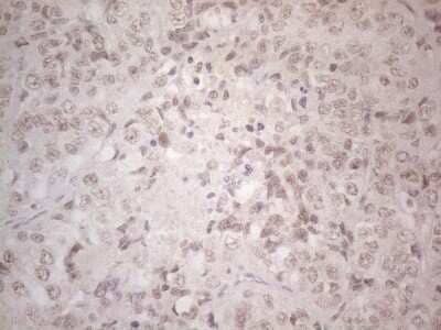 Immunohistochemistry: SPT3 Antibody (OTI1A5) - Azide and BSA Free [NBP2-74348]