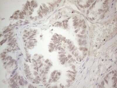 Immunohistochemistry: SPT3 Antibody (OTI1A5) - Azide and BSA Free [NBP2-74348]