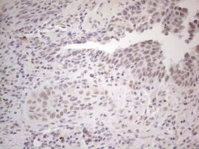 Immunohistochemistry: SPT3 Antibody (OTI1A5) - Azide and BSA Free [NBP2-74348]