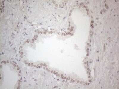Immunohistochemistry: SPT3 Antibody (OTI1A5) - Azide and BSA Free [NBP2-74348]