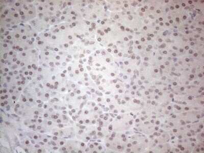 Immunohistochemistry: SPT3 Antibody (OTI1A5) - Azide and BSA Free [NBP2-74348]