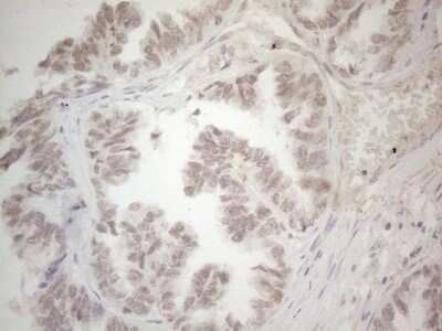 Immunohistochemistry: SPT3 Antibody (OTI1A5) [NBP2-45466]