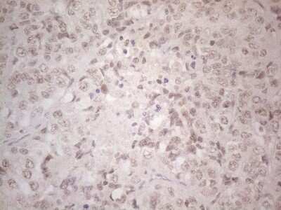 Immunohistochemistry: SPT3 Antibody (OTI1A5) [NBP2-45466]