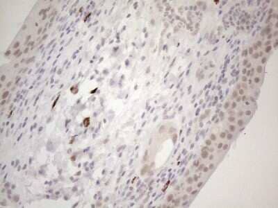Immunohistochemistry: SPT3 Antibody (OTI1A5) [NBP2-45466]