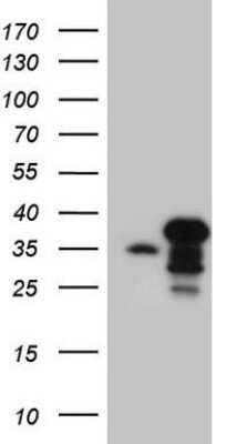 SDS-PAGE: SPT3 Antibody (OTI1A5) [NBP2-45466]