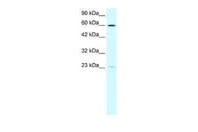 Western Blot: SPT3 Antibody [NBP2-85816]