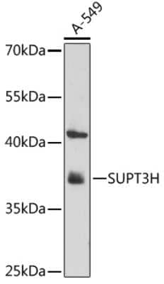 Western Blot: SPT3 AntibodyAzide and BSA Free [NBP2-94477]