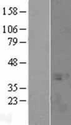 Western Blot: SPT3 Overexpression Lysate [NBL1-16616]