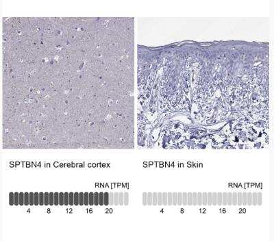 Immunohistochemistry-Paraffin: SPTBN4 Antibody [NBP2-49131]