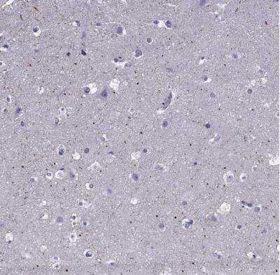 Immunohistochemistry-Paraffin: SPTBN4 Antibody [NBP2-49131]
