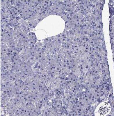 Immunohistochemistry-Paraffin: SPTBN4 Antibody [NBP2-49131]