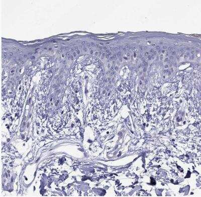 Immunohistochemistry-Paraffin: SPTBN4 Antibody [NBP2-49131]