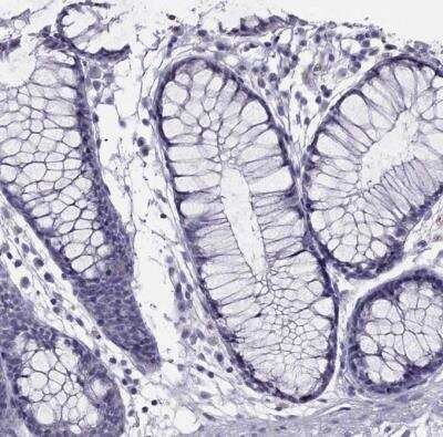 Immunohistochemistry-Paraffin: SPTBN4 Antibody [NBP2-49131]
