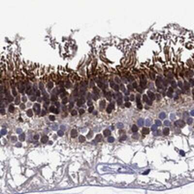 Immunohistochemistry-Paraffin: SPTBN5 Antibody [NBP3-17175]