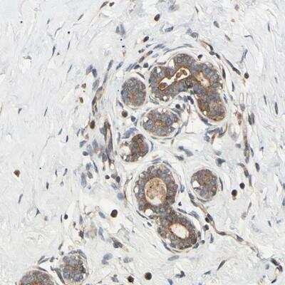 Immunohistochemistry-Paraffin: SPTLC1 Antibody [NBP1-81737]