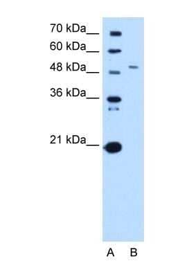 Western Blot: SPTLC1 Antibody [NBP1-59643]