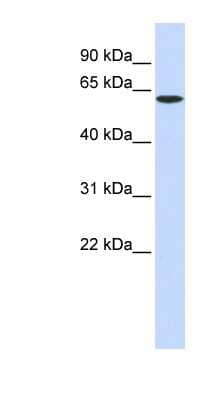 Western Blot: SPTLC1 Antibody [NBP1-59644]